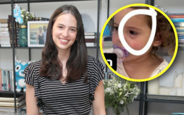 קורין גדעון על החרוז שנכנס לעין של בתה אלונה  (צילום: אור גפן,צילום מסך אינסטגרם)